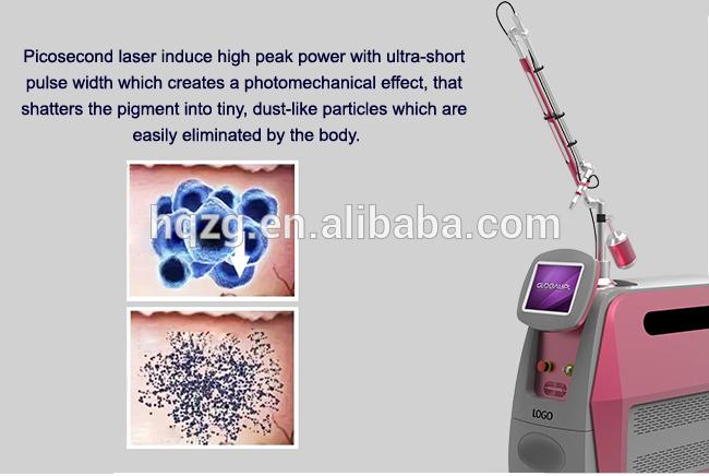 Picosecond laser 1.jpg